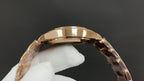 Gold-tone Patek Philippe watch case with curved bezel close-up on a glove